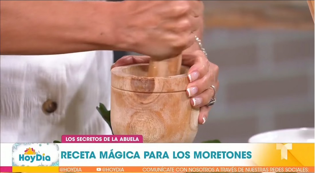 Deshazte de los moretones con este ungüento natural